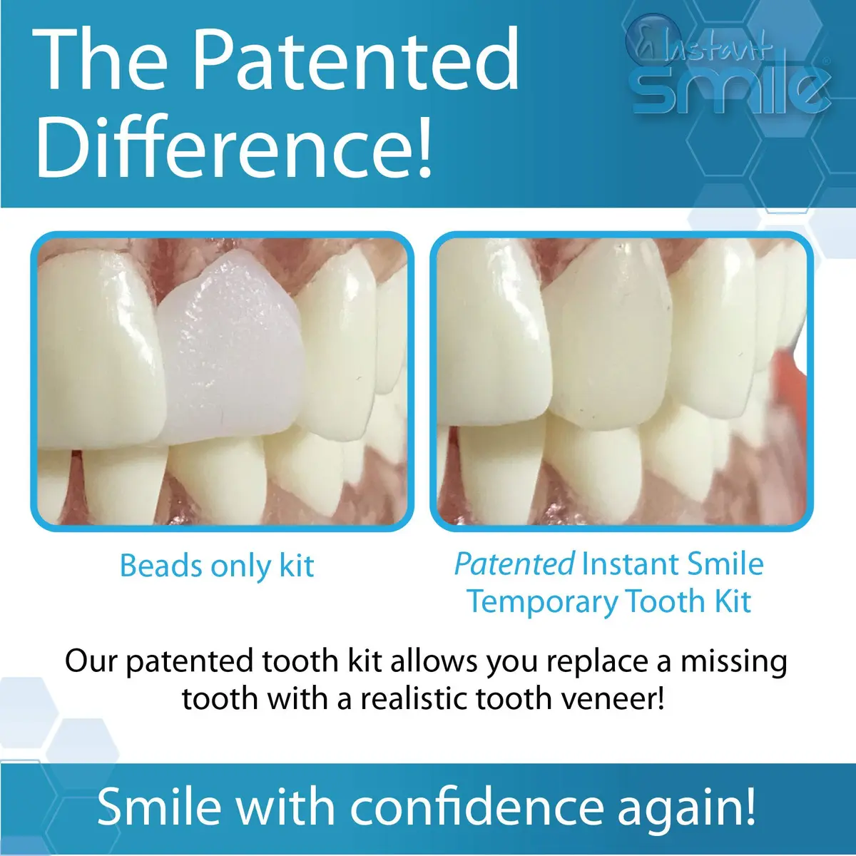 Instant Smile Complete Your Smile Temporary Tooth Replacement Kit - Replace a Missing Tooth in Minutes - Patented (Pack of 2) - view 4