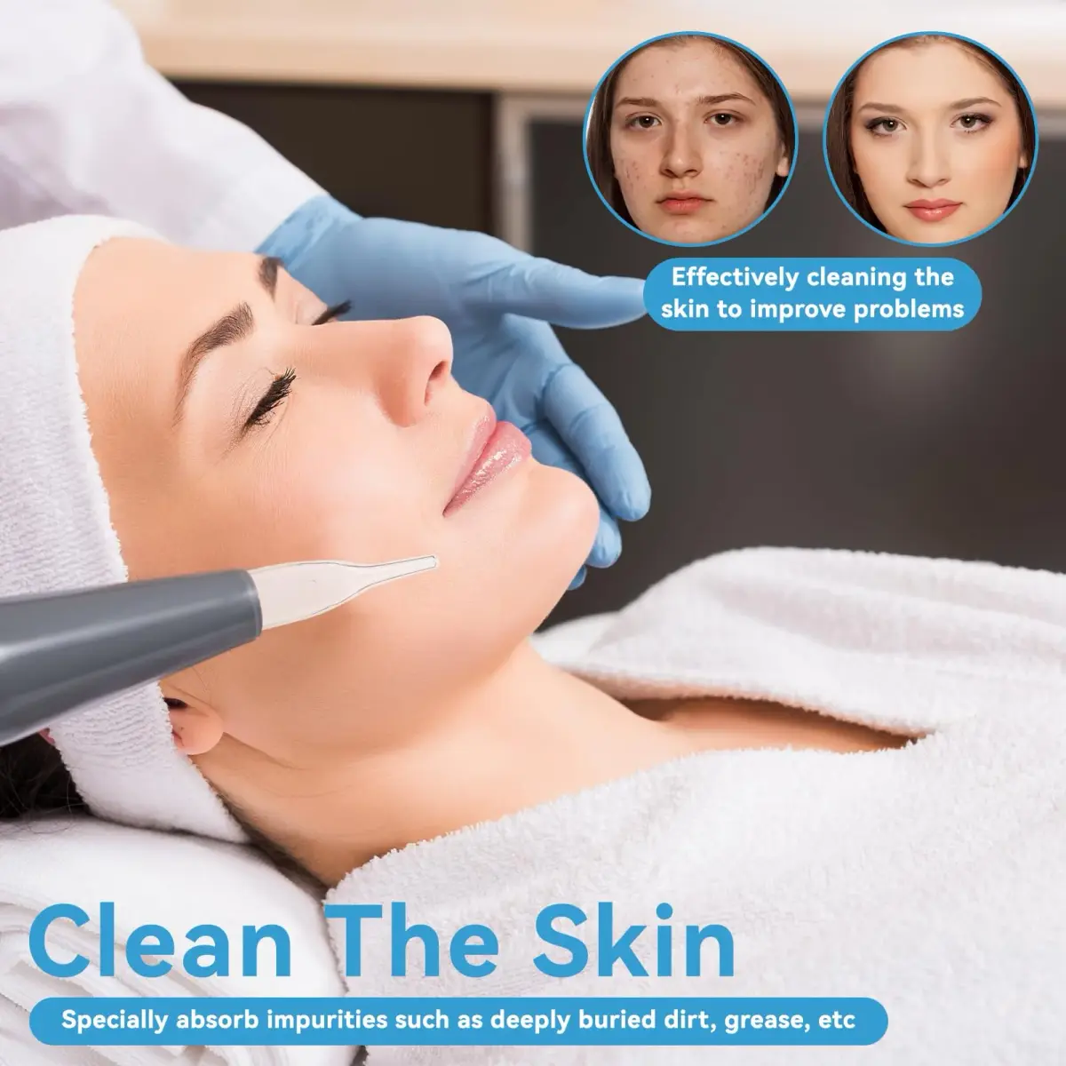 Agatige Blackhead Removal Glass Tube Kit (Pack of 3) | Vacuum Suction Pore Cleaner Accessories - view 3